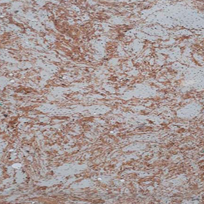 Đá Hoa Cương Marble Bursa Beige